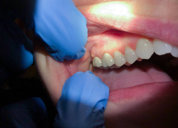 Best Broken or Cracked Tooth Emergency Dentist in Kingsland, TX