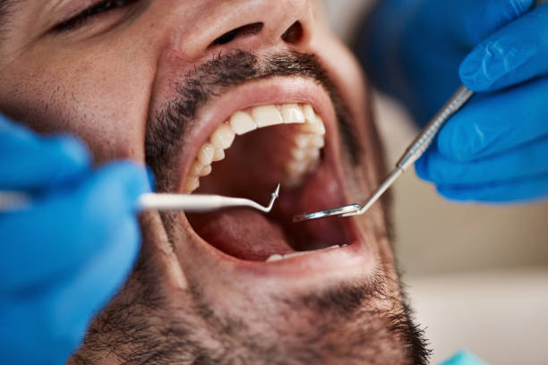 Best Pediatric Emergency Dentist in Kingsland, TX